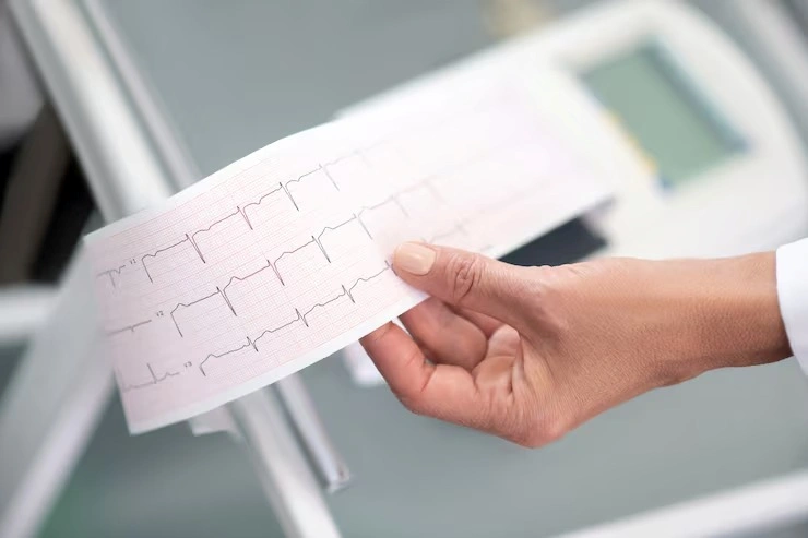 Eletrocardiograma exame