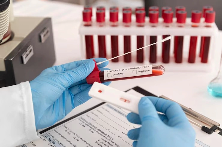 Exame toxicológico para motorista clt